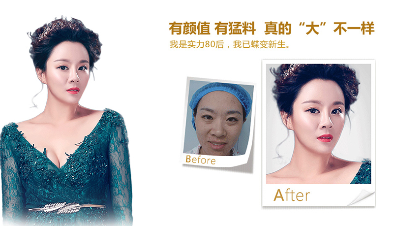 铜仁地区脂肪移植、隆鼻