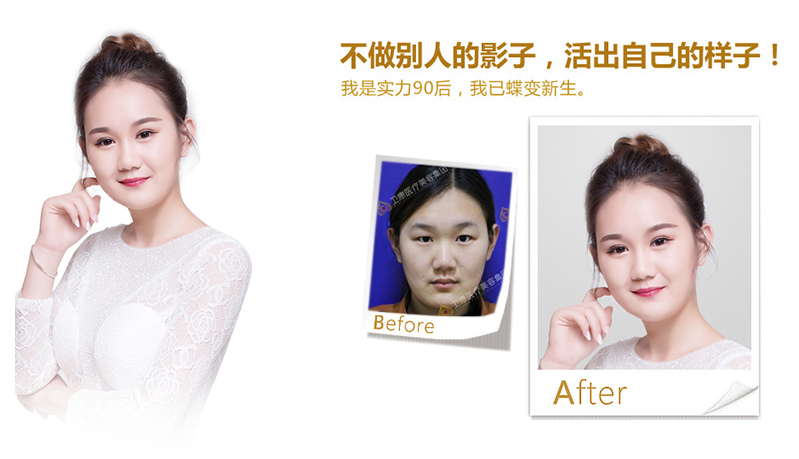 铜仁地区纳米脂肪移植