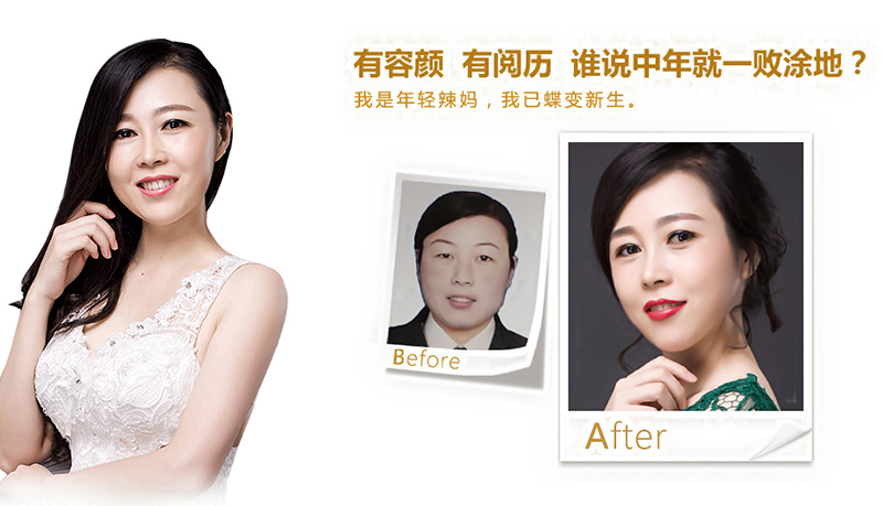 铜仁地区5D童颜术