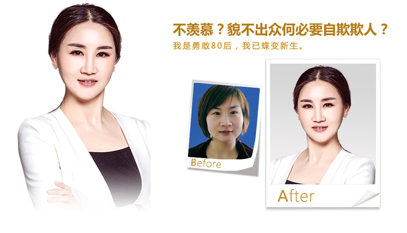 铜仁地区注射微雕