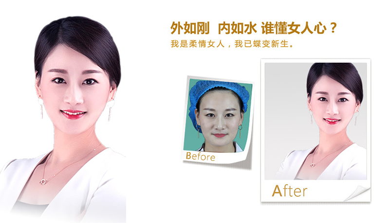 铜仁地区V脸、线雕隆鼻